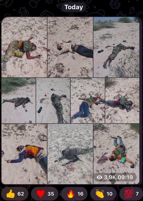 Somali Parliament Delegation Visits Wounded Troops After El-Dheer Battle